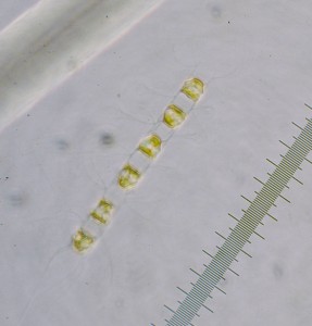 Chaetoceros