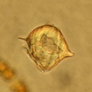 Protoperidinum Dinoflagelate