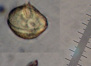 Protoperidinum Dinoflagelate