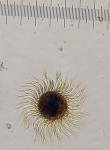 Strobilidium epacrum Ciliate Animal Plankton