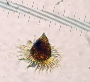Strobilidium epacrum Ciliate Animal Plankton